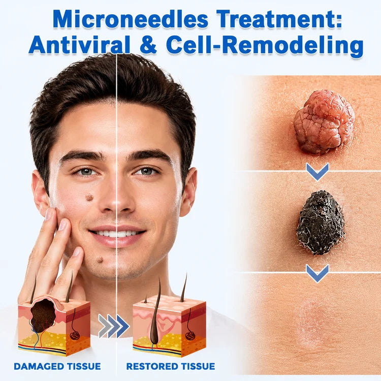 ✨Celviron 2‑in‑1 Microneedle Patch，Remove Skin Tags, Moles, Warts for Face & Body