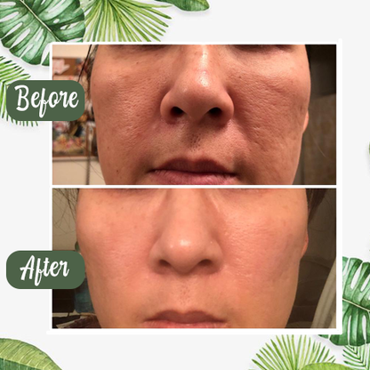 LOVILDS™  100% Natural Green Tea Deep Cleanse Mask