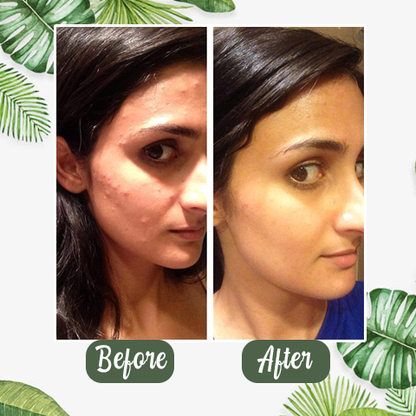 LOVILDS™  100% Natural Green Tea Deep Cleanse Mask