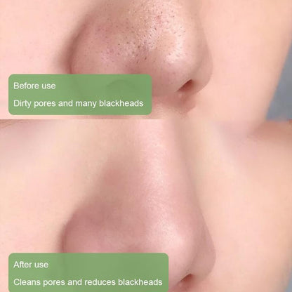 LOVILDS™  100% Natural Green Tea Deep Cleanse Mask