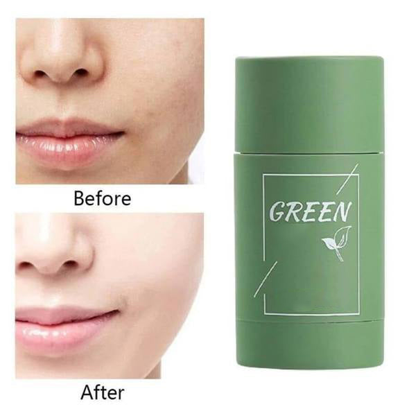 LOVILDS™  100% Natural Green Tea Deep Cleanse Mask