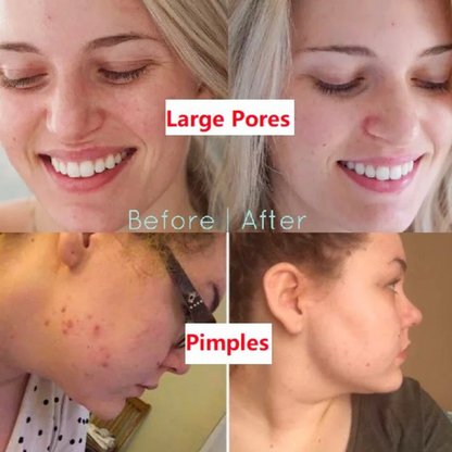 Deep Clean. Clear Pores.